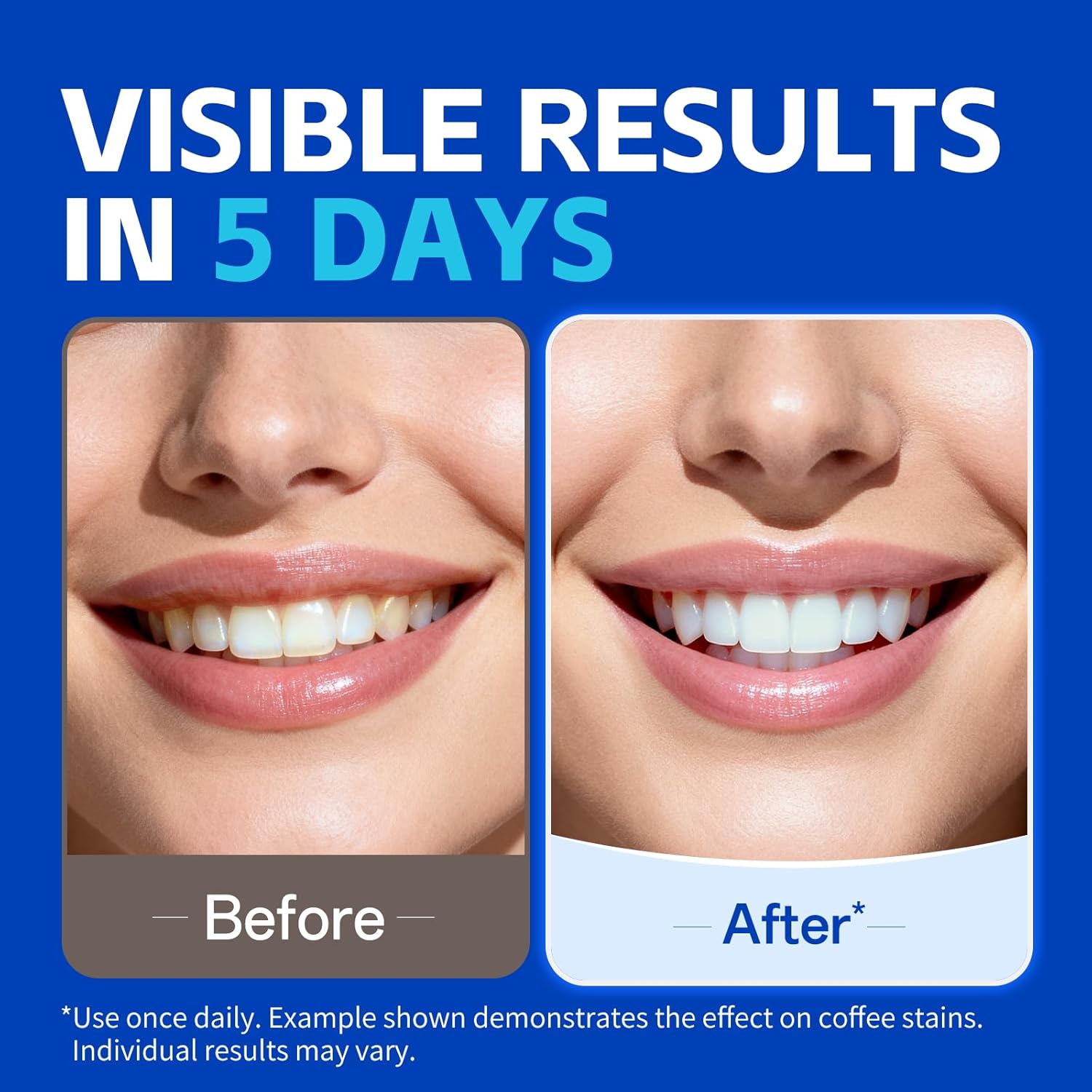 1/7ペアの歯のホワイトニングストリップでより白く見える笑顔 - Teeth Whitening Strips のレビューと価格